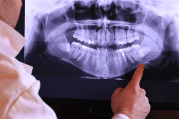 Best Emergency Dentist for Knocked-Out Tooth in Kimball, TN