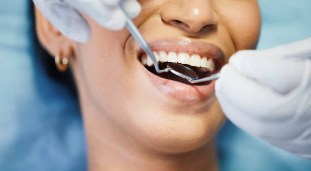 Best Emergency Dentist for Lost Fillings or Crowns in Kimball, TN